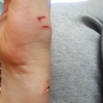 [사진ㅇ] 이거 자해한 것 같음?