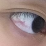 [조언부탁해] 나 눈 왜케빨개