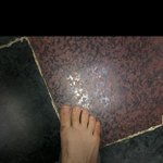 나처럼 <b>발</b> 잘 붓는 사람 있어?(<b>사진</b>있음)
