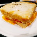 치아교정 2일 째
