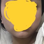 얼굴형 <b>개</b><b>노답</b>인데 머리 어째야되냐