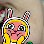 급함))치아<b>미백</b> 부작용(사진有) 꼭읽어주세요!!부작용났는데 이상한...