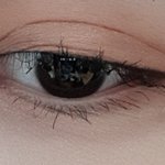 [댓글부탁해] 쌍수 해 본 사람~~