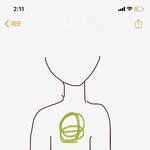 [댓글부탁해] 여기 아프면 어느 병원 가야해??ㅠㅠ
