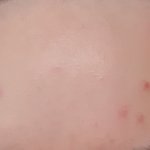 <b>피부</b> <b>꿀</b>팁좀 ㅠㅠㅠ급해