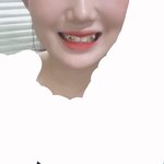 얘들아 나 <b>덧니</b>있는데 많이 이상해..?