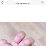 2년동안 <b>손톱모양</b>