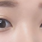 [꼭조언부탁] ㅋㅋ추가)))쌍수고민...이거 해야하나 말아야 하나...