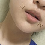 입<b>주위</b> 까만 거