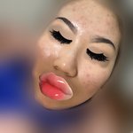 [댓글부탁해] 약혐 여드름 좀 더 괜찮아<b>진</b> 듯...!