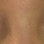 이눈 쌍수대박각임? 쌉가능??