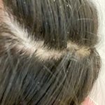 [드루와] 내 <b>비듬</b> 보고강~~~