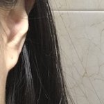 귓볼 막혀도 <b>자국</b> 있어??