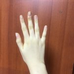 얘들아 나 손 평가 좀