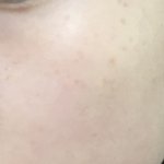 나 피부 좋은데