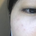 [꼭조언부탁] <b>기미크림</b> 정보좀부탁드려요 ㅠㅠ