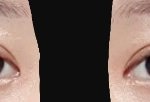 나 쌍수붓기 <b>마니</b>빠졌지