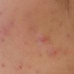 [댓글부탁해] 나 <b>로아</b>큐탄 먹을건데