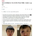 <b>런던</b> 한복판서 아시아계 학생 폭행.."코로나 싫다"