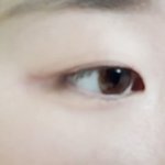 [드루와] 쌍수 할까말까