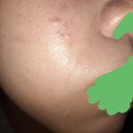 [드루와] 에스쁘아 비글로우 <b>개스</b>레기 이것좀봐