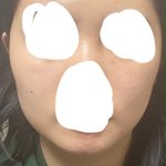 [댓글부탁해] 사각턱 보톡스 일주일차인데 <b>오때</b>?