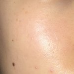 나 피부 되게 좋아보임 오늘따라.. 오른쪽만 (사진0)