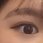 [댓글부탁해] 나 쌍수 1년찬데 재수술할지말지 고민이야