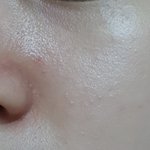 (사진ㅇ) <b>피부결</b>?이 안좋은 피부는 어떻게해야해?