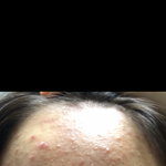 1주일만에 피부 개조<b>아짐</b>ㅇㅈ?
