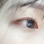 [댓글부탁해] 눈 <b>주위</b> 빨간 거 어케 없애...?
