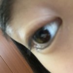 [댓글부탁해] 이거 <b>겉</b>다래끼야 <b>속</b>다래끼야? 제발 ㅠㅠ