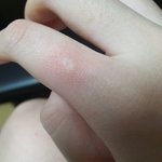 [드루와] 아니 벌써 모기가 나왔음;;;?