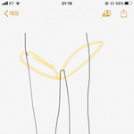 나 어릴때 팬티라인 살부분 되게 까맿는데