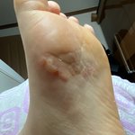 [사진혐주의] 대체 이거 뭔지 아는 분 ㅠㅜㅠ