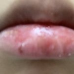 너넨..<b>입술</b> 뜯는 버릇 생기지 마라,,^^