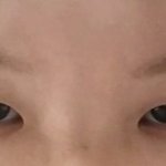 [조언부탁해] 님들 나 쌍수할까말까? 사진많음