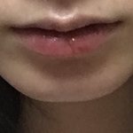 나 <b>심부</b>볼 빼면 하관 좀 나아질까?ㅠㅠ