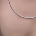 1년동안 내 피부 차이좀 볼래..?ㅋㅋ