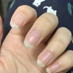 <b>손톱</b>관리 어떻게 해야돼ㅠㅠ