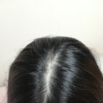 [댓글부탁해] 나 이거 탈모 맞냐