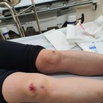 이마트 카트 미끄러져 모녀 부상
