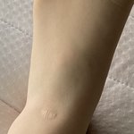 [드루와] 너네 <b>흉터</b> 가지고 있는 거 있어?