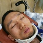 속보))엑소 첸 코로나 <b>확진</b>판정