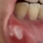 약혐주의) 나 <b>입안</b>에 조카이상한거남 이거뭐임
