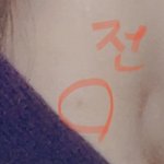 [꼭조언부탁] 시술 후 흉터 피부과 책임