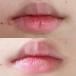 입술 비대칭 쫌 나아진거같지??