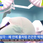 [19] 애들아 코로나 조심해 단순한 <b>폐렴</b>이아님