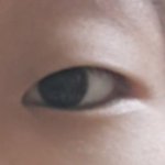 <b>쌍수</b>후기! !@-@