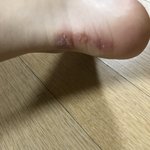 나 운동화만 신으면 뒷<b>꿈치</b> 이렇게 되는데